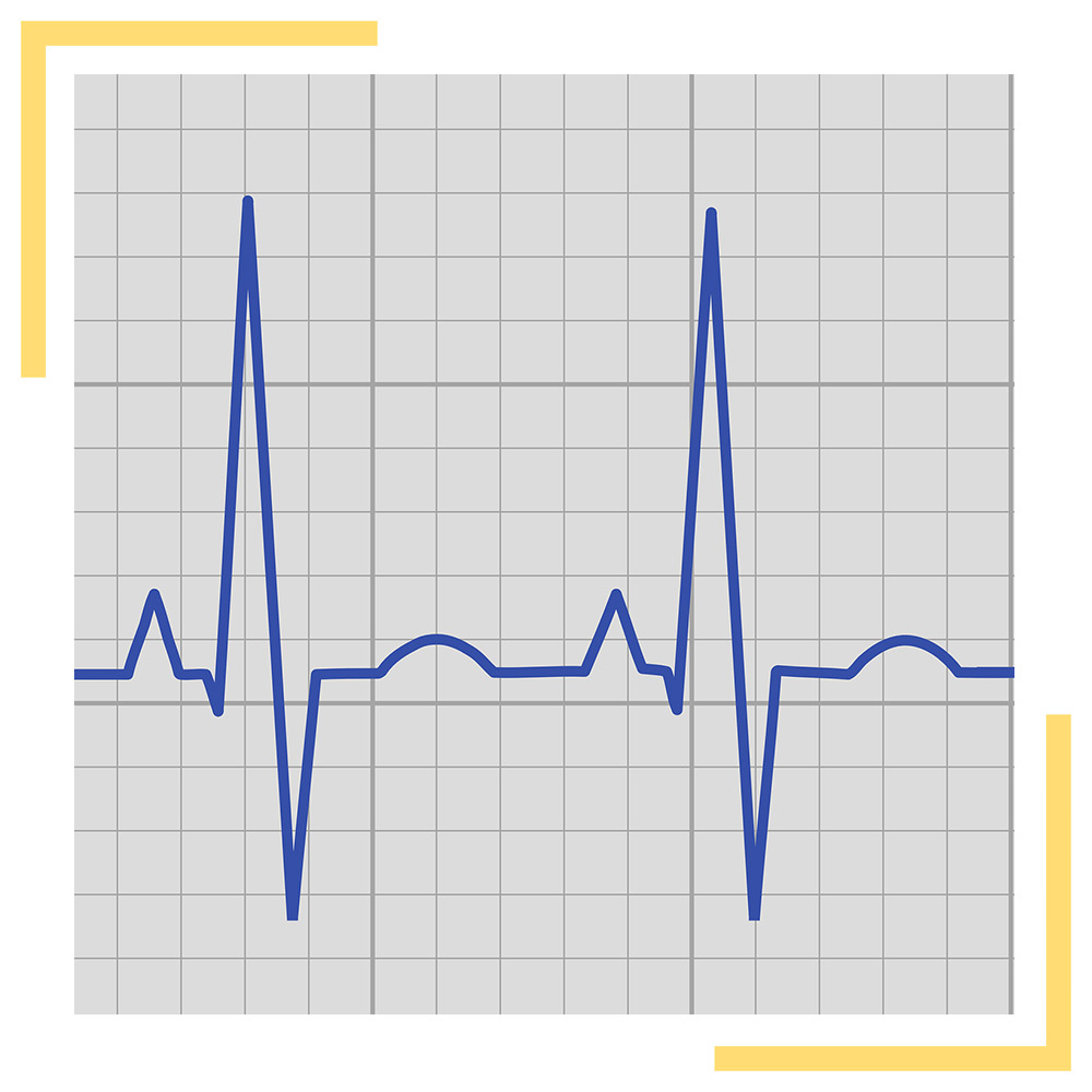 Lire et analyser l’entreprise avec le prisme de l'assurance collective